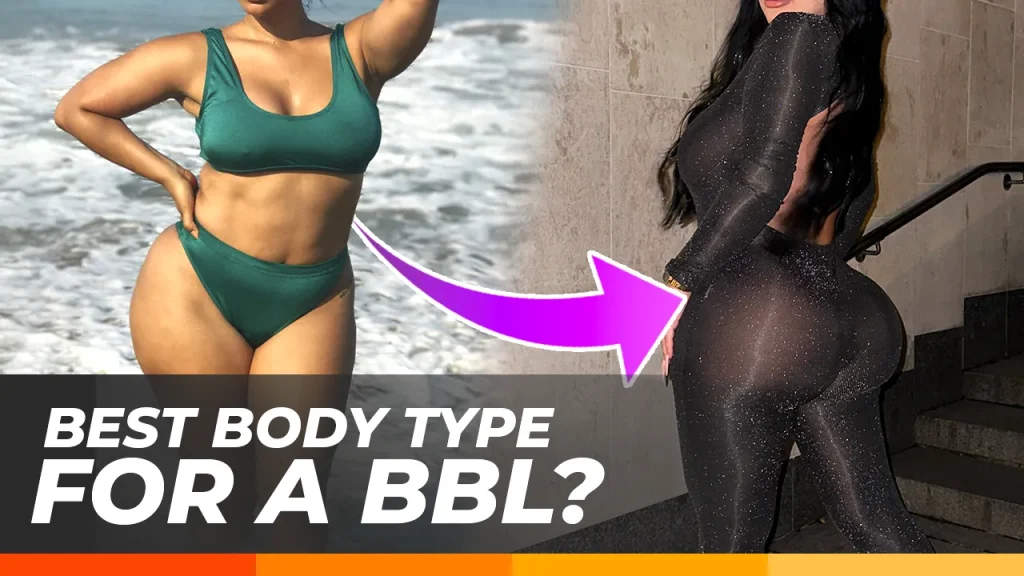 Best Body Types for BBL | Who’s a Good Candidate for Brazilian Butt Lift